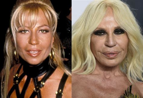 La Transformación de Donatella Versace: Antes y Después de su 